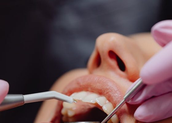 A dentist is cleaning a patient's teeth in a dental office, with dental tools and equipment visible in the background.